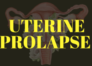 Uterine Prolapse: Caring for Your Pelvic Health Through Menopause